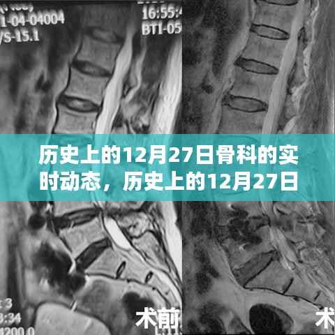 历史上的骨科领域动态,聚焦十二月二十七日的实时进展概览