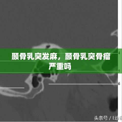 颞骨乳突发麻,颞骨乳突骨瘤严重吗