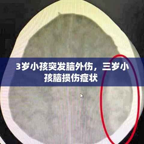 3岁小孩突发脑外伤,三岁小孩脑损伤症状