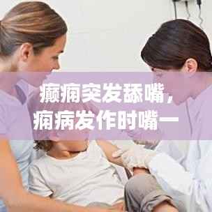 癫痫突发舔嘴,痫病发作时嘴一直在咀嚼